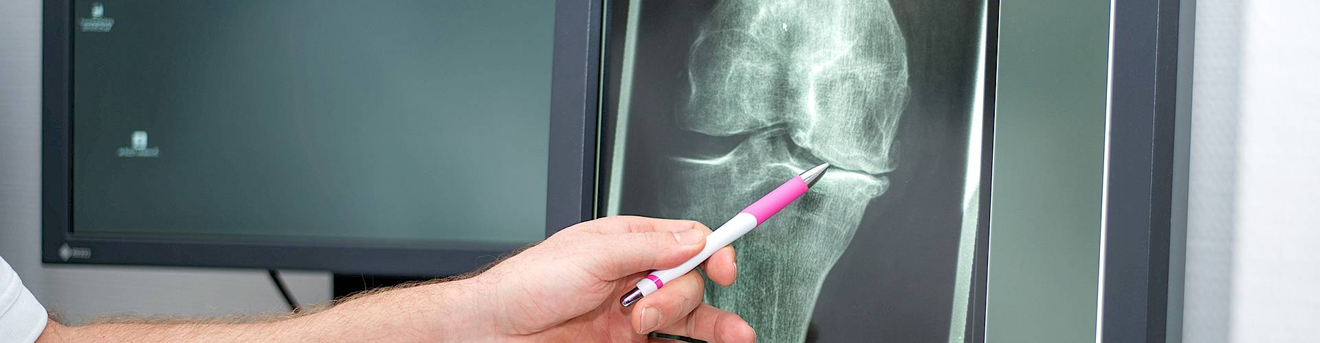 Dr. Walde erklärt Röntgenaufnahme eines Knies mit schwerer Arthrose
