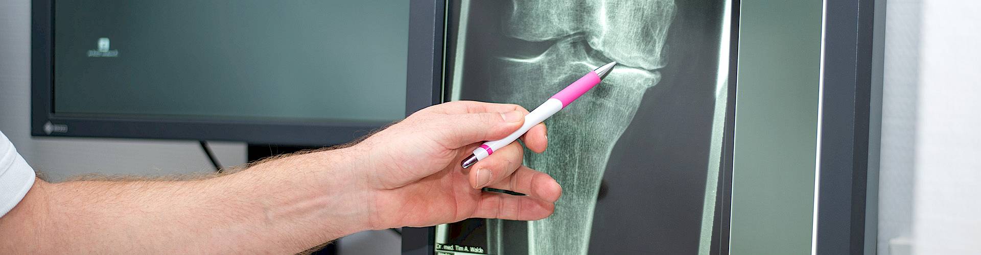 Dr. Walde erklärt Befund Röntgenaufnahme Knie